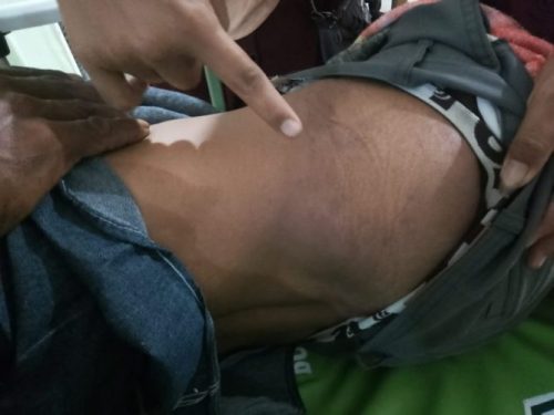 Pelaku Pengeroyokan atau Penganiayaan Belum Ditangkap, Keluarga Korban Tuding Polisi ‘Masuk Angin’